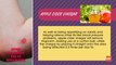 Ringworm Home Remedies Health Tone Tips Cube Films