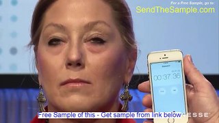Botox Specials - Warning Watch This Video First