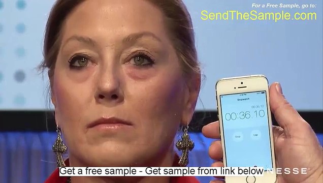 Avoid Botox Cost - Watch this 2 minute Clip and Results