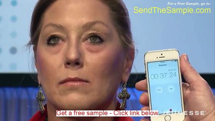 Botox before and after picture - Watch this important Clip - Melbourne , FL