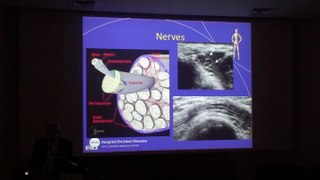 Ultrasound Guided Injections in the Musculoskeletal System - Ronald S. Adler