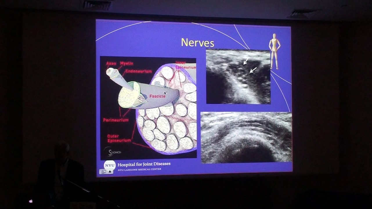 Ultrasound Guided Injections in the Musculoskeletal System - Ronald S. Adler
