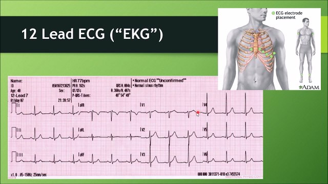 Differentiating Acute Coronary Syndrome (ACS) - (Nursing)
