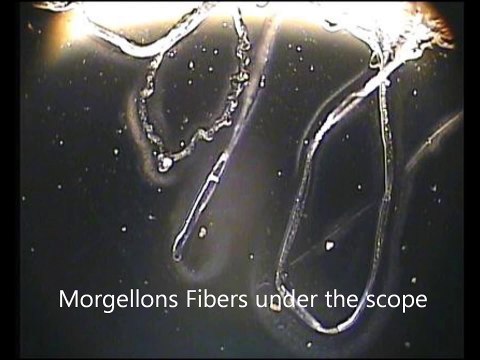 Shocking connection between Chemtrails, Morgellons, and GMO FOODS. Experts provide proof.