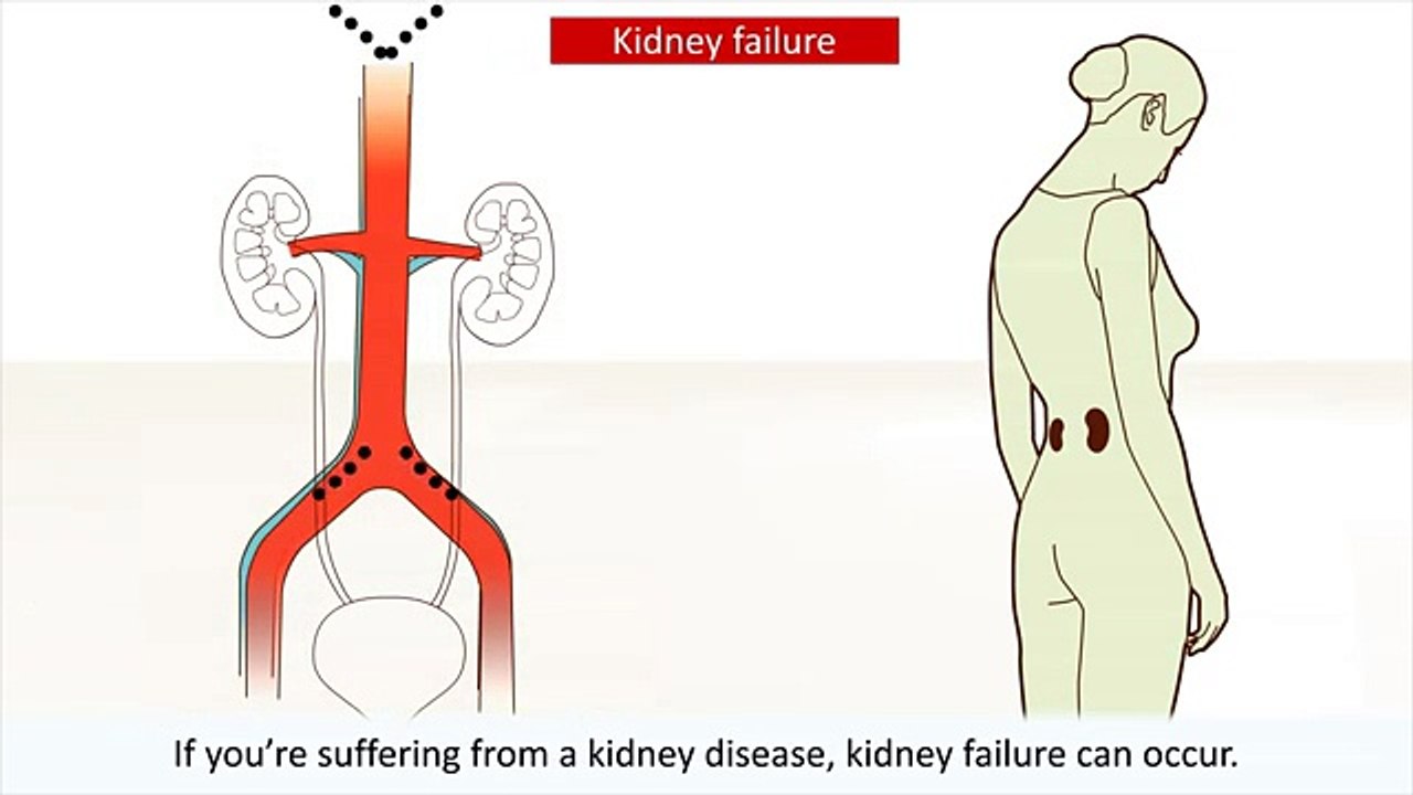 renal failure-syptoms and treatment