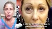Instantly Ageless Reviews | Jeunesse Instantly Ageless Before and After Photos
