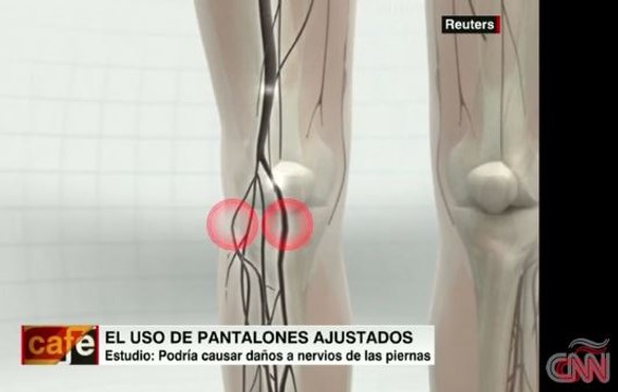 Cuidado con los jeans ajustados: Su uso puede ser peligroso