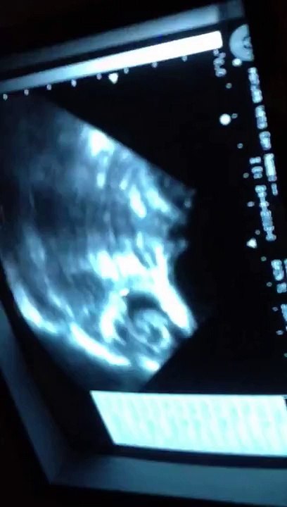 Day 41 dog pregnancy scan