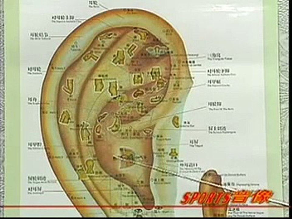 DIY 健康保健耳穴按摩 (14) 治疗失眠