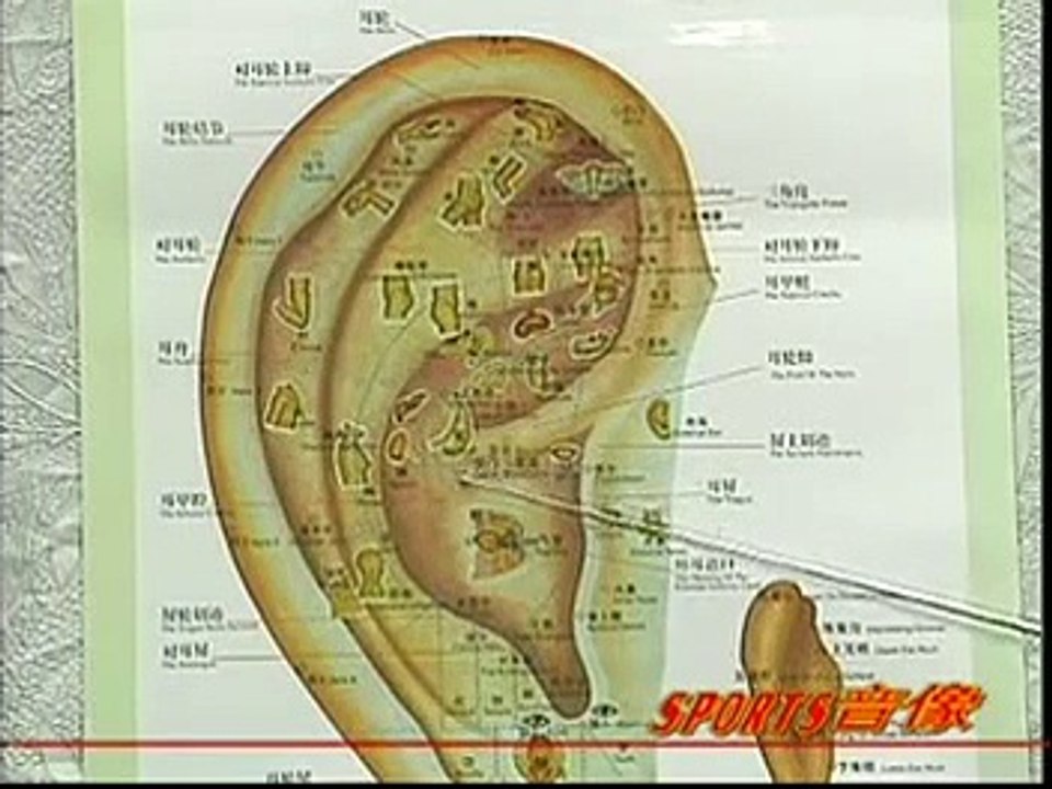 DIY 健康保健耳穴按摩 (25) 治疗晕车