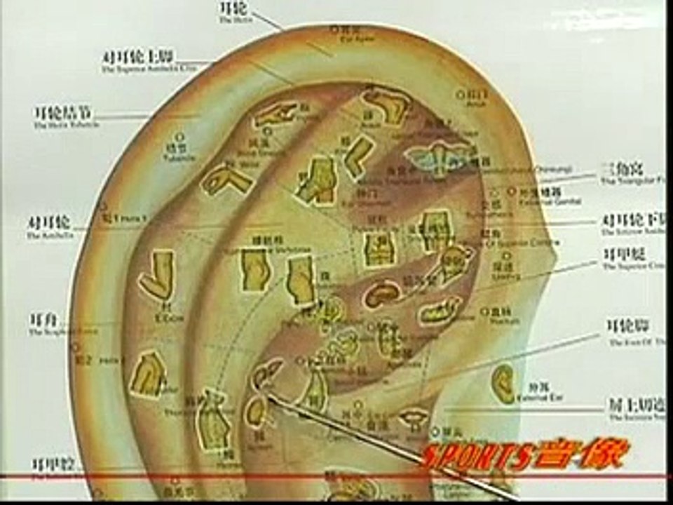 DIY 健康保健耳穴按摩 (27) 治疗急性腰扭伤