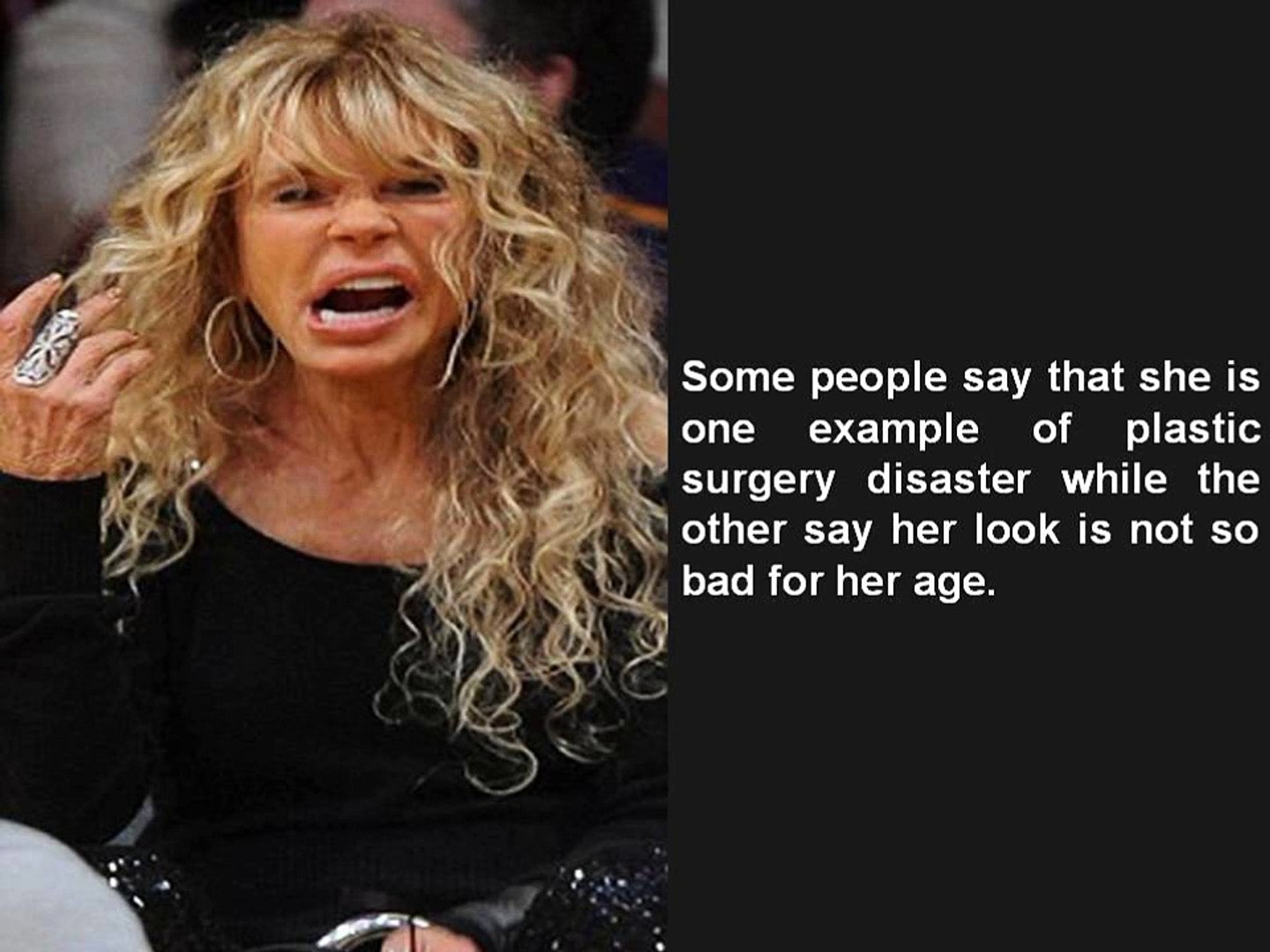 Dyan Cannon Plastic Surgery