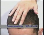 Alopecia capilar: Solucion con Fibras Capilares, densificador de pelo natural. Nanogen