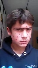 Piçlik bu olsa gerek