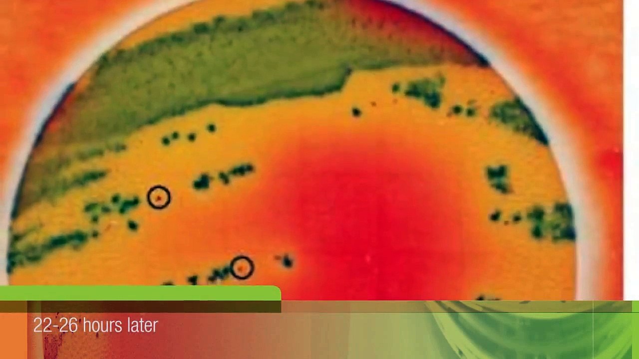3M™ Petrifilm™ Salmonella Express System - Product Highlights