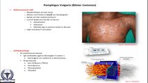 Pemphigus Vulgaris (Blister Disease)