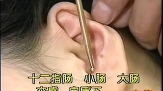 DIY 健康保健耳穴按摩 (28) 二十种常见病的治疗