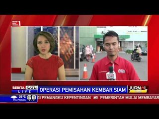 RSPAD Gatot Subroto Operasi Pemisahan Kembar Siam