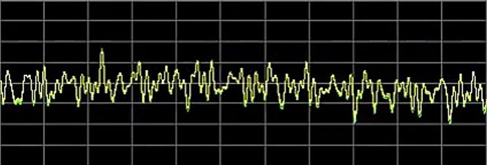 Cysts - Rife Frequencies