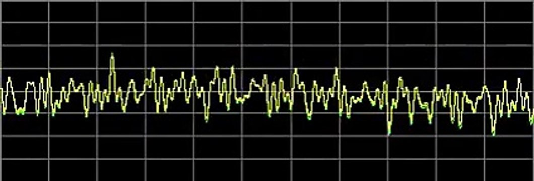 Cysts - Rife Frequencies