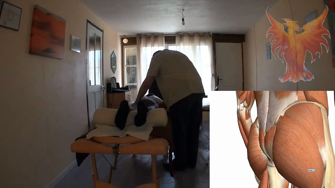 Sciatique traitée en magnetisme et points trigger par un magnetiseur Jean Angius