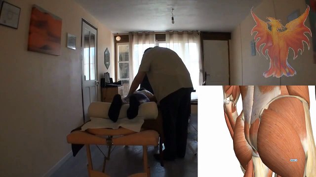 Sciatique traitée en magnetisme et points trigger par un magnetiseur Jean Angius