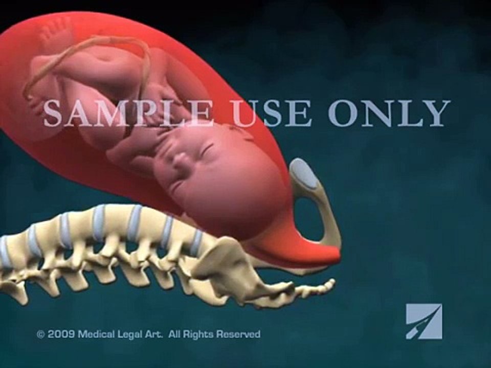 Normal Vaginal Birth