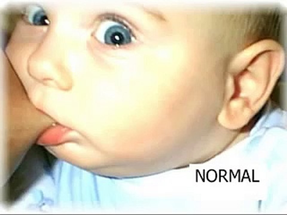 Breastfeeding Advertisement