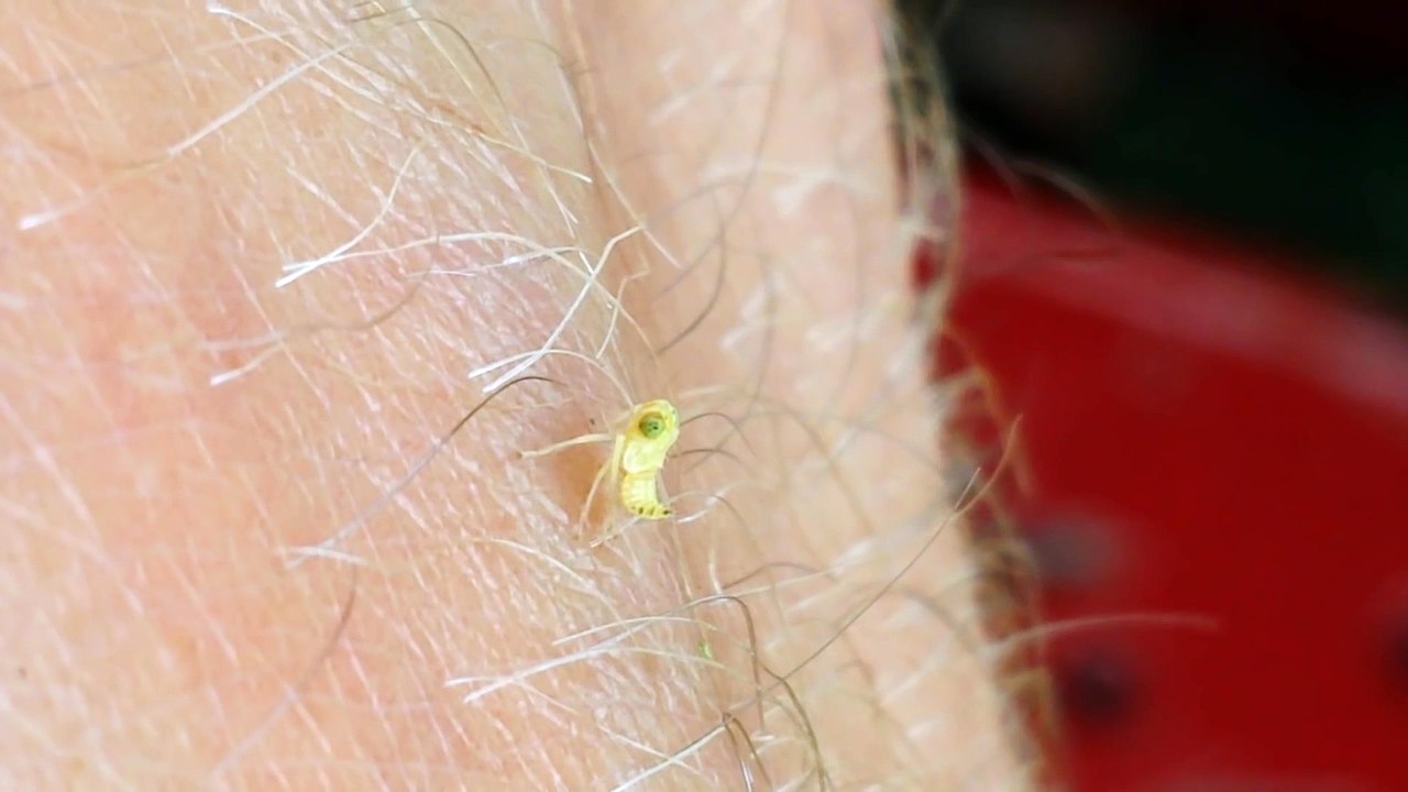 Il fait danser un mini insecte sur sa main - Trop mignon