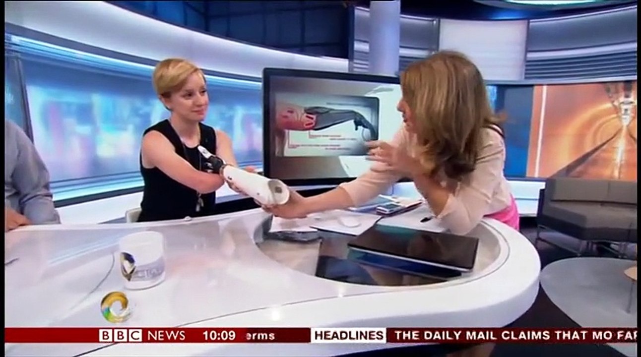 First woman with real bionic hand demonstrates it use