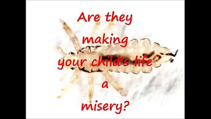 How to Remove Lice from Hair in One Day