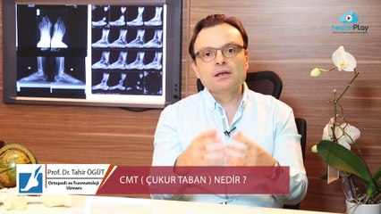 Prof. Dr. Tahir ÖĞÜT - CMT (ÇUKUR TABAN) NEDİR ?
