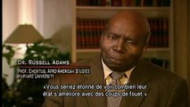 Psychiatrie: allumer les feux du racisme