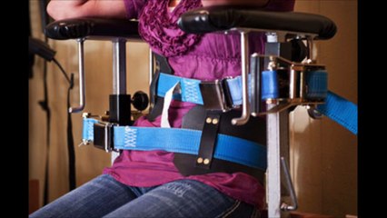 Life with Scoliosis: Disfigurement or Contentment