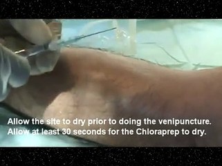 Peripheral IV Catheter Insertion Demo (2 of 2)