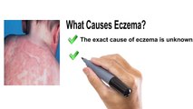 _Eczema Free Forever Review - Really Best Eczema Treatment or Scam_