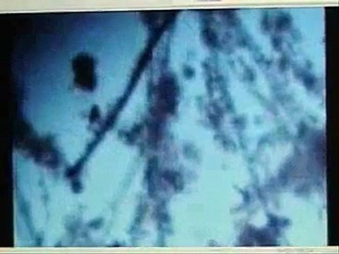 Chemtrail and Morgellon: DEPOPULATION!