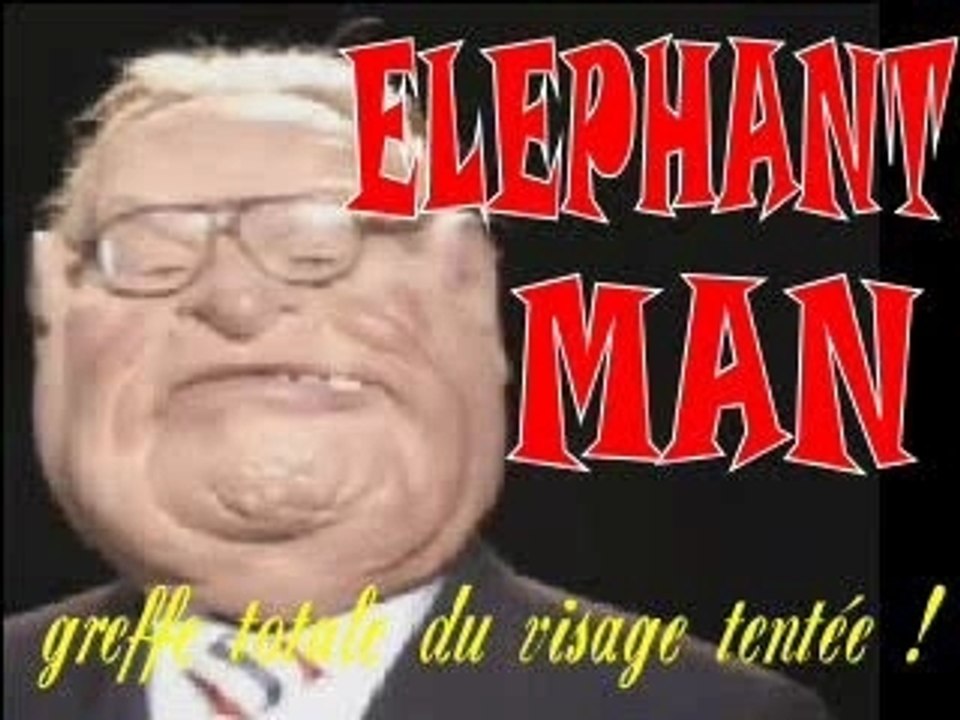 Eléphant man