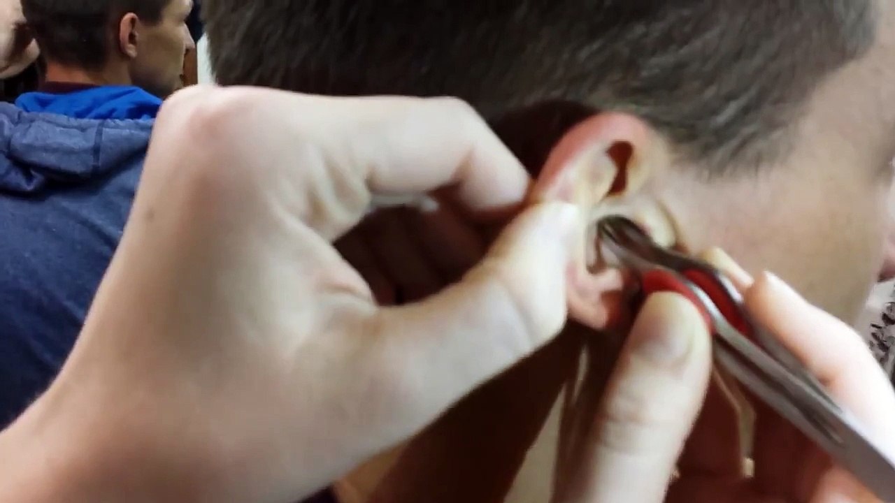 Regardez ce qu'il avait dans l'oreille !