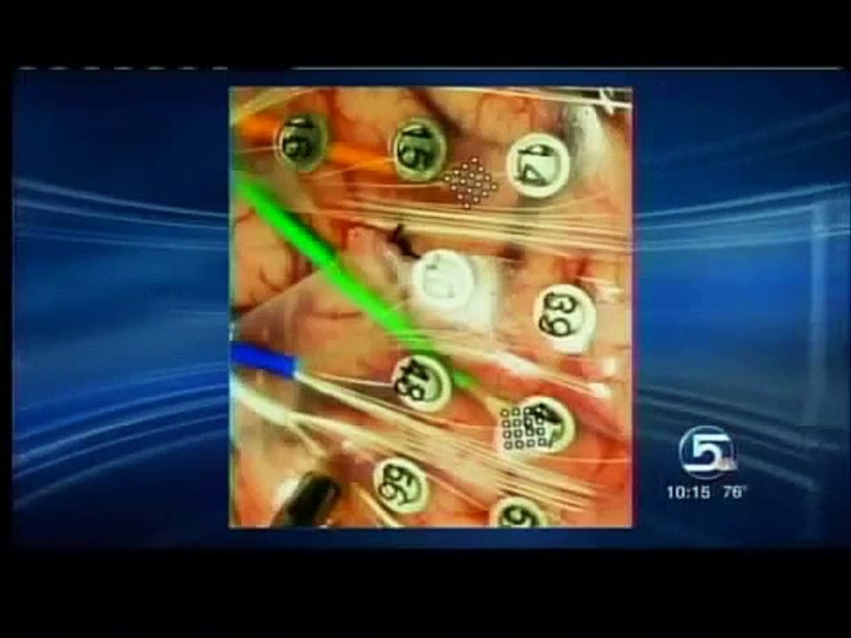 U. scientists decode words from brain signals