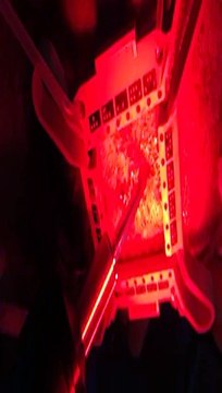 Opération de prélèvement avec le robot ARTAS The Clinic Paris