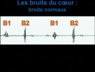 Auscultation cardiaque : Les bruits normaux du cœur