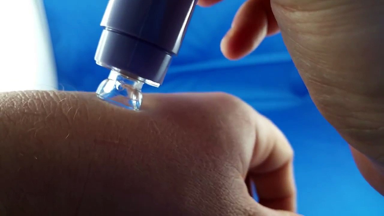 Pore Blackhead Acne Cleanser Cleaner Remover from Aliexpress.com