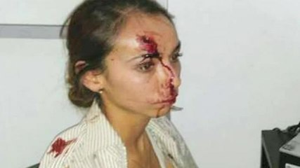 Nacho Lozano. Golpean a reportera por denunciar irregularidades en Silao