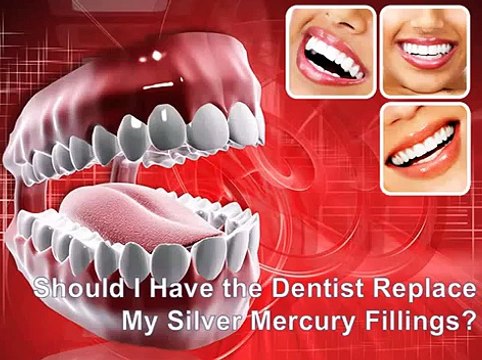 Should I Have the Dentist Replace My Silver Mercury Fillings-