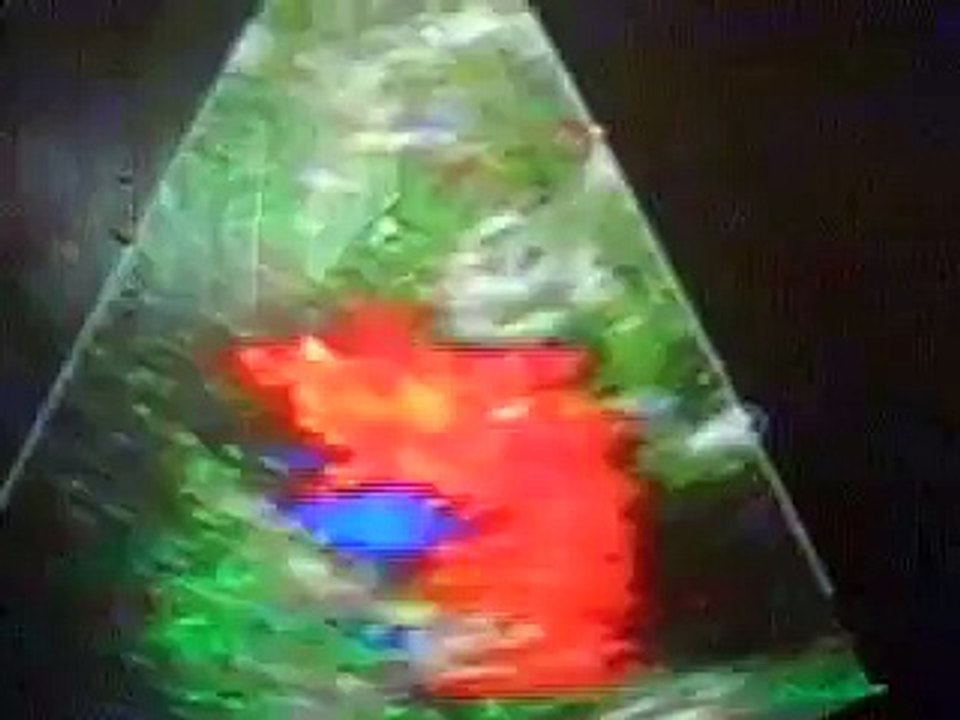 Echocardiography