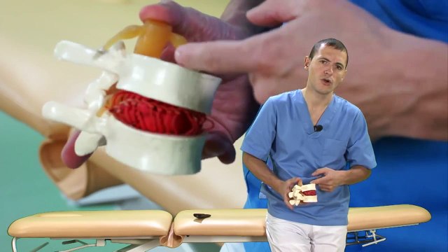 Hernia discal lumbar y protrusión discal. Signos radiológicos.