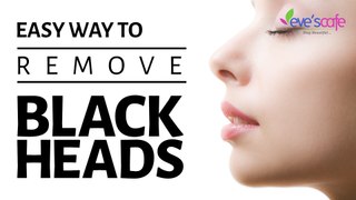 Remove Blackheads and Whiteheads at Home - DIY