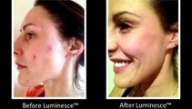 Jeunesse® Global LUMINESCE™ Amazing Before & After Photos