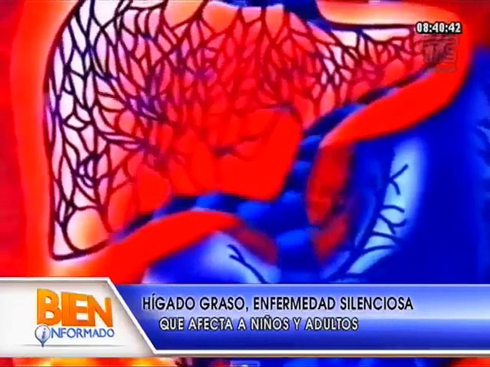 Bien Informado - ¿Cómo prevenir el hígado graso?